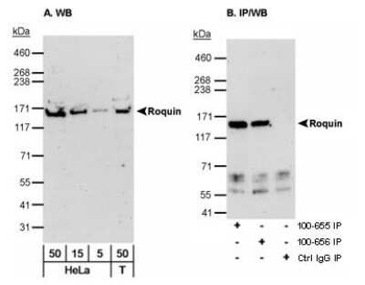 Western Blot Roquin Antibody