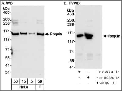 Western Blot: Roquin Antibody [NB100-656] - Samples: A) Whole cell lysate from HeLa (5, 15 and 50 ug) and 293T (T, 50 ug) cells.  B) Whole cell lysate (1 mg/IP; 1/4 of IP loaded) from HeLa cells.  Antibodies: Affinity purified rabbit anti-Roquin antibody NB100-656 used at 0.04 ug/ml for WB (A and B) and at 3 ug/mg lysate for IP (B).  Roquin was also immunoprecipitated using rabbit anti-Roquin antibody NB100-655 at 3 ug/mg lysate.  Detection: Chemiluminescence with an exposure time of 30 seconds.