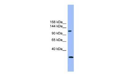 Western Blot: Rubicon Antibody [NBP2-85681] - WB Suggested Anti-KIAA0226 Antibody Titration: 0.2-1 ug/ml. ELISA Titer: 1:1562500. Positive Control: Human Placenta