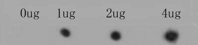 Dot Blot: Ryanodine Receptor 1 Antibody [NBP2-76960] - Dot blot analysis of anti-RYR1 immunization peptide on PVDF. 1ug, 2ug and 4ug peptides were given in this test. Anti-RYR1 antibody was diluted with 1/500.