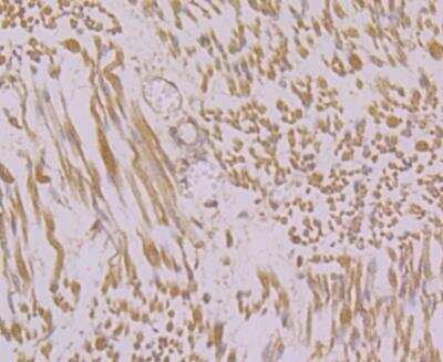 Immunohistochemistry: Ryanodine Receptor 1 Antibody [NBP2-76960] - Immunohistochemical analysis of paraffin-embedded human fetal skeletal muscle tissue using anti-RYR1 antibody. Counter stained with hematoxylin.