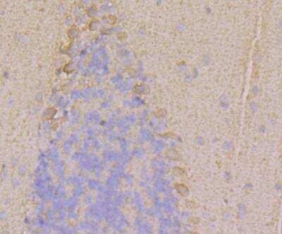 Immunohistochemistry: Ryanodine Receptor 1 Antibody [NBP2-76960] - Immunohistochemical analysis of paraffin-embedded mouse cerebellum tissue using anti-RYR1 antibody. Counter stained with hematoxylin.