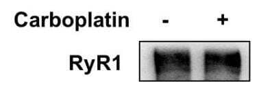 Western Blot: Ryanodine Receptor 1 Antibody [46140002] - Human breast cancer cell MDA-MB-231 was treated with carboplatin for 72 hours and the expression of RyR1 was detected by Western blot. Image from verified customer review.