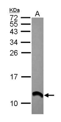 Western Blot: S100 alpha 2 Antibody [NBP2-20247] - Sample (30 ug of whole cell lysate) A: A431 15% SDS PAGE gel, diluted at 1:10000.