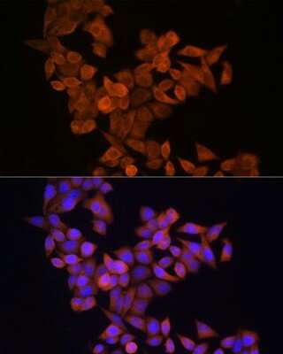 Immunocytochemistry/ Immunofluorescence S100 calcium binding protein A14 Antibody - BSA Free