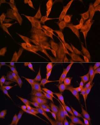 Immunocytochemistry/ Immunofluorescence S100 calcium binding protein A14 Antibody - BSA Free