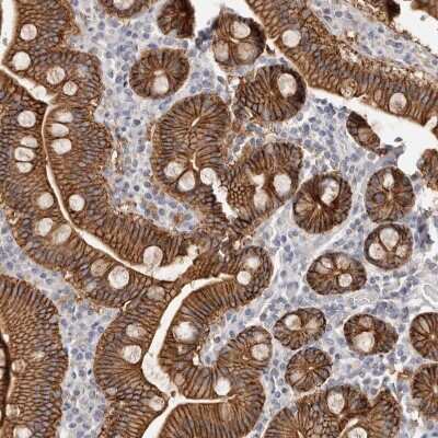 Immunohistochemistry-Paraffin: S100 calcium binding protein A14 Antibody [NBP1-90000] - Staining of human duodenum shows moderate membranous positivity in glandular cells.