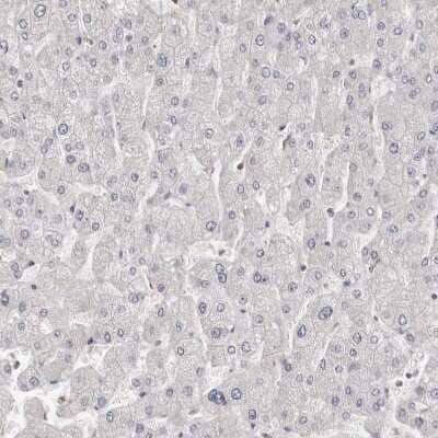 Immunohistochemistry-Paraffin: S100 calcium binding protein A14 Antibody [NBP1-90000] - Staining of human liver shows no positivity in hepatocytes as expected.