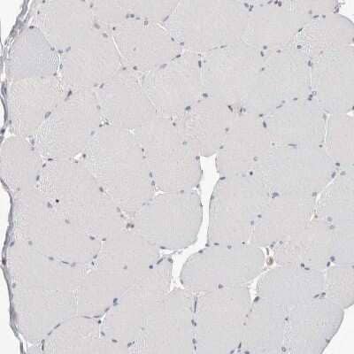 Immunohistochemistry-Paraffin: S100 calcium binding protein A14 Antibody [NBP1-90000] - Staining of human skeletal muscle shows no positivity in myocytes as expected.