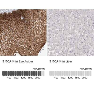 Immunohistochemistry-Paraffin: S100 calcium binding protein A14 Antibody [NBP1-90000] - Analysis in human esophagus and liver tissues using NBP1-90000 antibody. Corresponding S100A14 RNA-seq data are presented for the same tissues.