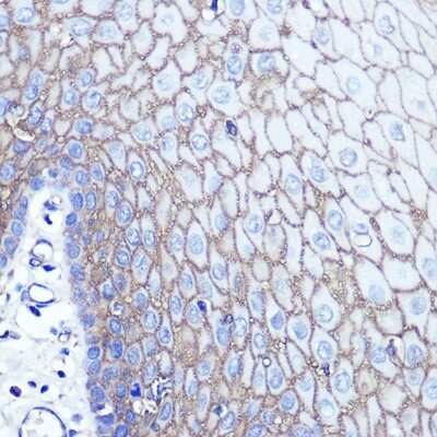 Immunohistochemistry-Paraffin: S100 calcium binding protein A14 Antibody [NBP2-93478] - Human esophageal using S100A14 Rabbit pAb at dilution of 1:100 (40x lens).