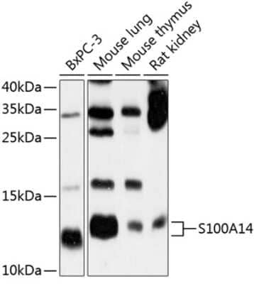 Western Blot: S100 calcium binding protein A14 Antibody [NBP2-93478] - Analysis of extracts of various cell lines, using S100 calcium binding protein A14 at 1:1000 dilution. Secondary antibody: HRP Goat Anti-Rabbit IgG (H+L) at 1:10000 dilution. Lysates/proteins: 25ug per lane. Blocking buffer: 3% nonfat dry milk in TBST. Detection: ECL Basic Kit . Exposure time: 30s.