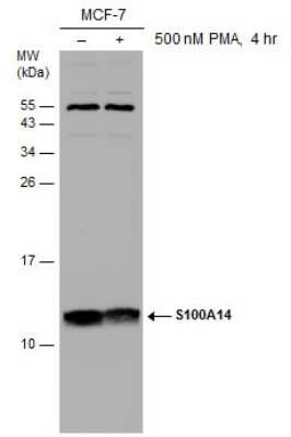 Western Blot: S100 calcium binding protein A14 Antibody [NBP3-12990] - Untreated (-) and treated (+) MCF-7 whole cell extracts (30 ug) were separated by 15% SDS-PAGE, and the membrane was blotted with S100 calcium binding protein A14 antibody (NBP3-12990) diluted at 1:1000.