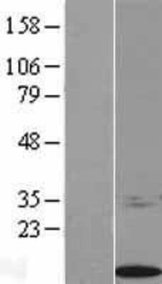 Western Blot S100 calcium binding protein A14 Overexpression Lysate