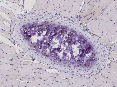 Immunohistochemistry-Paraffin: S100A1 Antibody (004) [NBP2-90503] - Immunochemical staining of human mouse S100A1 in mouse bone with rabbit monoclonal antibody (1:200, formalin-fixed paraffin embedded sections). Positive staining was localized to chondrocyte.