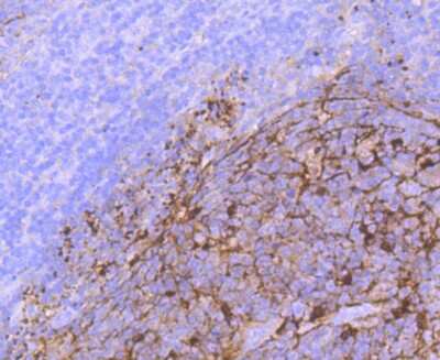 Immunohistochemistry-Paraffin: S100A1 Antibody (JM51-31) [NBP2-67119] - Analysis of paraffin-embedded human tonsil tissue using anti- S100 antibody. Counter stained with hematoxylin.