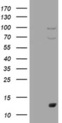 Western Blot: S100A1 Antibody (OTI6G4) - Azide and BSA Free [NBP2-73967] - Analysis of HEK293T cells were transfected with the pCMV6-ENTRY control (Left lane) or pCMV6-ENTRY S100A1.