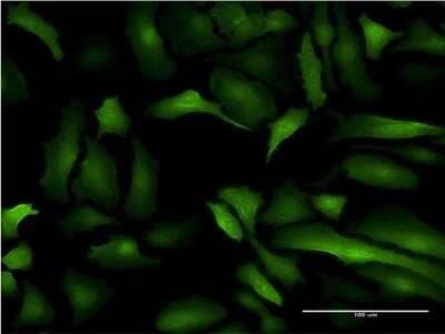 Immunocytochemistry/Immunofluorescence: S100A10 Antibody (3E10) [H00006281-M09] - Analysis of monoclonal antibody to S100A10 on HeLa cell. Antibody concentration 10 ug/ml