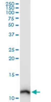 Western Blot: S100A10 Antibody (3E10) [H00006281-M09] - Analysis of S100A10 expression in HeLa (Cat # L013V1).