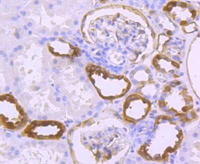 Immunohistochemistry-Paraffin: S100A10 Antibody (JF0987) [NBP2-67122] - Analysis of paraffin-embedded human kidney tissue using anti-S100A10 antibody. Counter stained with hematoxylin.