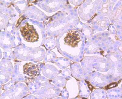 Immunohistochemistry-Paraffin: S100A10 Antibody (JF0987) [NBP2-67122] - Analysis of paraffin-embedded mouse kidney tissue using anti-S100A10 antibody. Counter stained with hematoxylin.