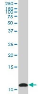 Western Blot: S100A10 Antibody [H00006281-B01P] - Analysis of S100A10 expression in human lung cancer.
