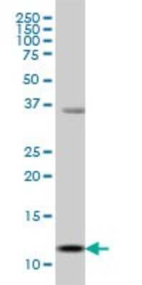 Western Blot: S100A13 Antibody (3A7) [H00006284-M01] - S100A13 monoclonal antibody (M01), clone 3A7 Analysis of S100A13 expression in MCF-7.