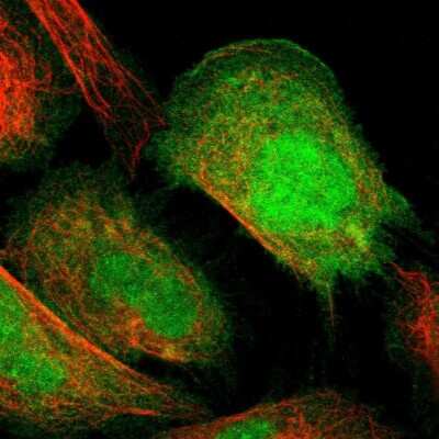 Immunocytochemistry/Immunofluorescence: S100A13 Antibody [NBP1-86039] - Immunofluorescent staining of human cell line U-2 OS shows localization to nucleus, plasma membrane & cytosol. Antibody staining is shown in green.