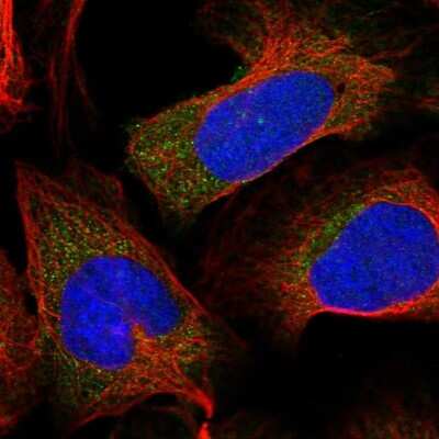 Immunocytochemistry/Immunofluorescence: S100A16 Antibody [NBP1-92361] - Immunofluorescent staining of human cell line U-2 OS shows localization to cytosol.