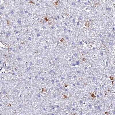 Immunohistochemistry-Paraffin S100A16 Antibody