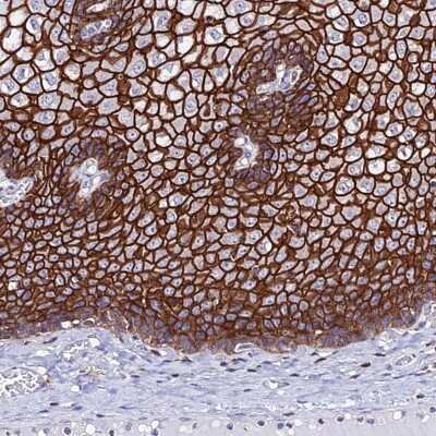 Immunohistochemistry-Paraffin S100A16 Antibody