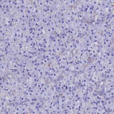 Immunohistochemistry-Paraffin S100A16 Antibody