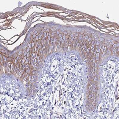 Immunohistochemistry-Paraffin: S100A16 Antibody [NBP1-92361] - Staining of human skin shows moderate membranous positivity in squamous epithelial cells.