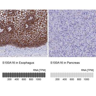 Immunohistochemistry-Paraffin S100A16 Antibody - BSA Free
