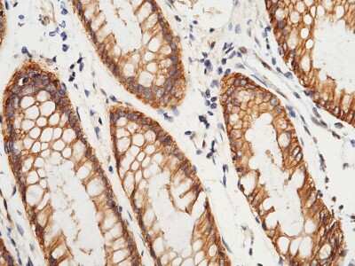 Immunohistochemistry-Paraffin: S100A16 Antibody [NBP2-99717] - Immunochemical staining of human S100A16 in human brain with rabbit polyclonal antibody at 1:5000 dilution, formalin-fixed paraffin embedded sections.
