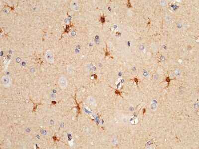 Immunohistochemistry-Paraffin: S100A16 Antibody [NBP2-99717] - Immunochemical staining of human S100A16 in human colon with rabbit polyclonal antibody at 1:5000 dilution, formalin-fixed paraffin embedded sections.