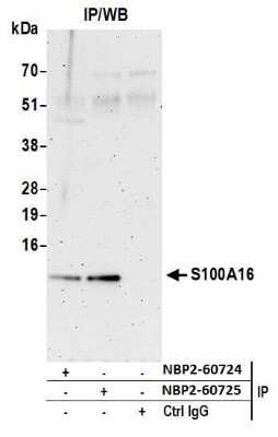 Immunoprecipitation: S100A16 Antibody [NBP2-60724] - Detection of immunoprecipitates. Samples: Whole cell lysate (0.5 or 1.0 mg per IP reaction; 20% of IP loaded) from HeLa cells prepared using NETN lysis buffer. Antibodies: Affinity purified rabbit anti-S100A16 antibody NBP2-60724 used for IP at 8 ul per reaction. S100A16 was also immunoprecipitated by rabbit anti-S100A16 antibody NBP2-60725. For blotting immunoprecipitated S100A16, NBP2-60724 was used at 1:400. Detection: Chemiluminescence with an exposure time of 3 minutes.