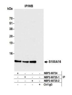 Immunoprecipitation: S100A16 Antibody [NBP2-60725] - Detection of human S100A16 by western blot of immunoprecipitates. Samples: Whole cell lysate (1.0 mg per IP reaction; 20% of IP loaded) from HeLa cells prepared using NETN lysis buffer. Antibodies: Affinity purified Rabbit anti-S100A16 antibody NBP2-60725 (lot NBP2-60725-2) used for IP at 20 ul per reaction. S100A16 was also immunoprecipitated by a previous lot of this antibody (lot NBP2-60725-1) and rabbit anti-S100A16 antibody NBP2-60724. For blotting immunoprecipitated S100A16, NBP2-60725 was used at 1:1000. Detection: Chemiluminescence with an exposure time of 10 seconds.