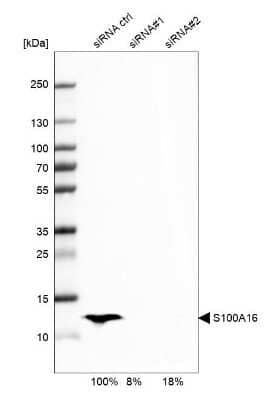 <b>Genetic Strategies Validation and Orthogonal Strategies Validation.</b>Western Blot: S100A16 Antibody [NBP1-92361] - Analysis in SK-BR-3 cells transfected with control siRNA, target specific siRNA probe #1 and #2, using Anti-S100A16 antibody. Remaining relative intensity is presented. Loading control: Anti-GAPDH.