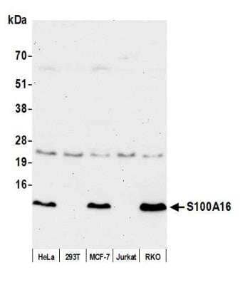 Western Blot: S100A16 Antibody [NBP2-60725] - Detection of human S100A16 by western blot. Samples: Whole cell lysate (50 ug) from HeLa, HEK293T, MCF-7, Jurkat, and RKO cells prepared using NETN lysis buffer. Antibody: Affinity purified rabbit anti-S100A16 antibody NBP2-60725 used for WB at 1:1000. Detection: Chemiluminescence with an exposure time of 30 seconds.