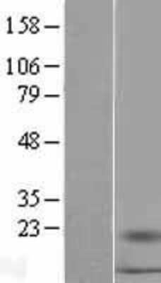 Western Blot: S100A16 Overexpression Lysate (Adult Normal) [NBL1-15653] Left-Empty vector transfected control cell lysate (HEK293 cell lysate); Right -Over-expression Lysate for S100A16.