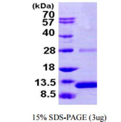 SDS-Page: S100A2  Recombinant Protein [NBP1-51023]