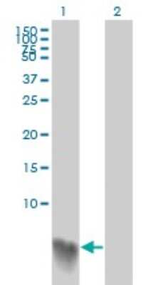 Western Blot: S100A2 Antibody (3H8) [H00006273-M03] - Analysis of S100A2 expression in transfected 293T cell line by S100A2 monoclonal antibody (M03), clone 3H8. Lane 1: S100A2 transfected lysatE (11 KDa). Lane 2: Non-transfected lysate.