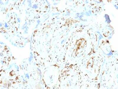 Immunohistochemistry-Paraffin: S100A2 Antibody (CPTC-S100A2-2) - Azide and BSA Free [NBP2-79899] - Formalin-fixed, paraffin-embedded human Placenta stained with S100A2 Mouse Monoclonal Antibody (CPTC-S100A2-2).