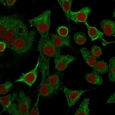 Immunocytochemistry/Immunofluorescence: S100A2 Antibody (CPTC-S100A2-2) [NBP2-79764] - Immunofluorescence Analysis of A549 cells labeling S100A2 with S100A2 Antibody (CPTC-S100A2-2) followed by Goat anti-Mouse IgG-CF488 (Green). The nuclear counterstain is RedDot (Red)