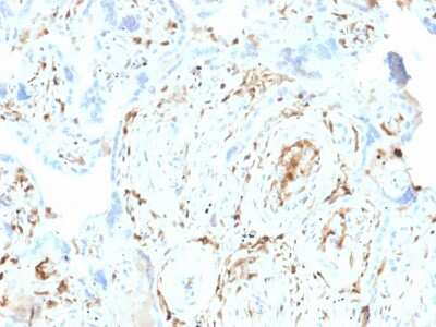 Immunohistochemistry-Paraffin: S100A2 Antibody (CPTC-S100A2-2) [NBP2-79764] - Formalin-fixed, paraffin-embedded human Placenta stained with S100A2 Antibody (CPTC-S100A2-2).