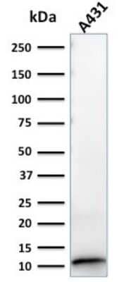 Western Blot: S100A2 Antibody (CPTC-S100A2-2) [NBP2-79764] - Western Blot Analysis of A431 cell lysate using S100A2 Antibody (CPTC-S100A2-2).