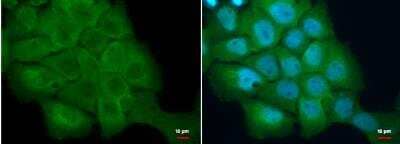 Immunocytochemistry/Immunofluorescence: S100A2 Antibody [NBP2-20247] - A431 cells were fixed in 4% paraformaldehyde/PBS for 15 min. Green: S100A2 protein stained by S100A2 antibody [N1C3]  diluted at 1:500. Blue: Hoechst 33342 staining.