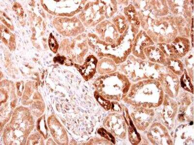 Immunohistochemistry-Paraffin: S100A2 Antibody [NBP2-20247] - Human normal kidney.  S100A2 antibody [N1C3] diluted at 1:500. Antigen Retrieval: Trilogy™ (EDTA based, pH 8.0) buffer, 15min. 