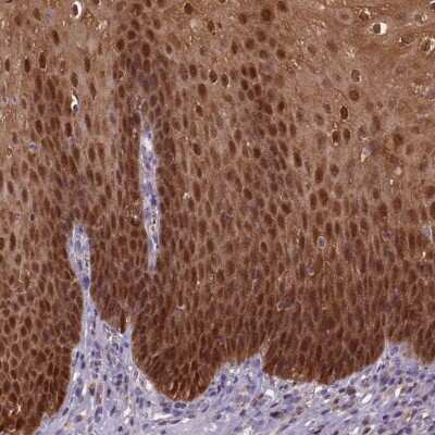 Immunohistochemistry-Paraffin: S100A2 Antibody [NBP2-38959] - Staining of human esophagus shows strong positivity in squamous epithelial cells.